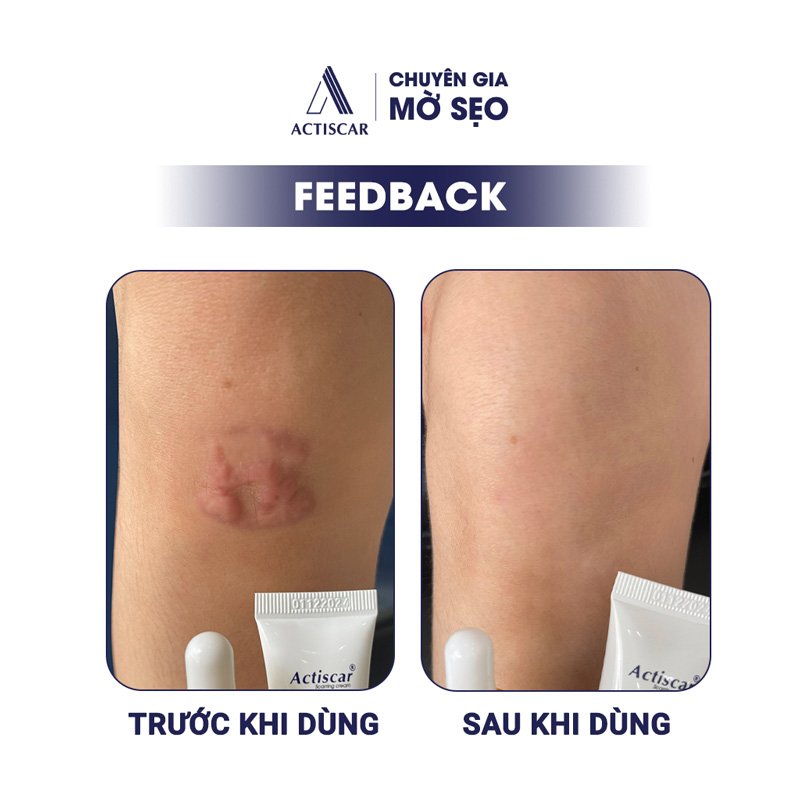 Feedback của khách hàng về viên uống Actiscar