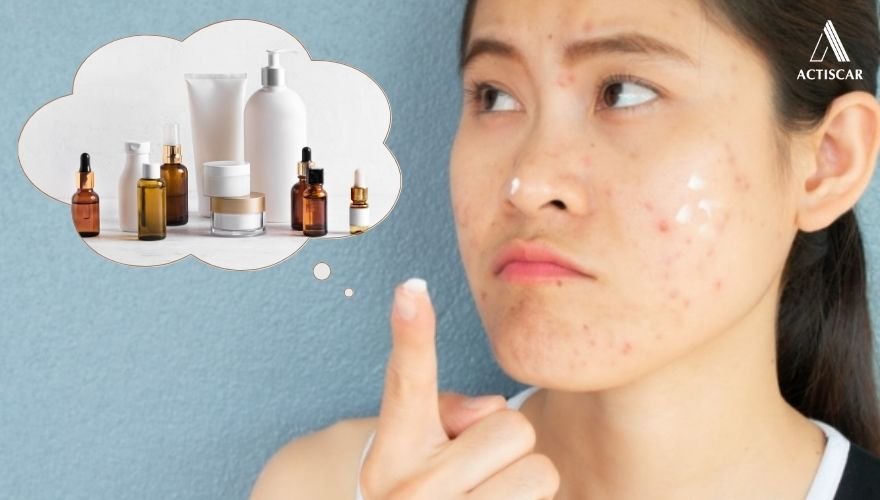 Lựa chọn kem trị sẹo lâu năm phù hợp để tối ưu hiệu quả