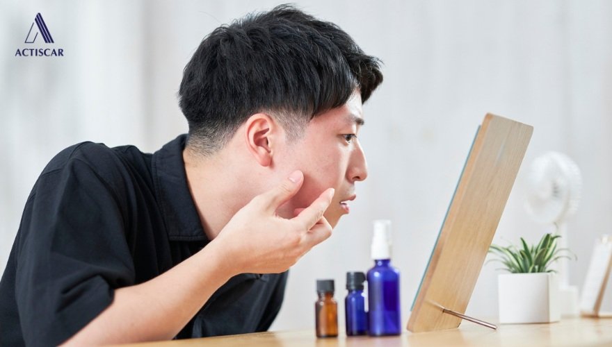Chăm sóc và ngăn ngừa sẹo rỗ tại nhà