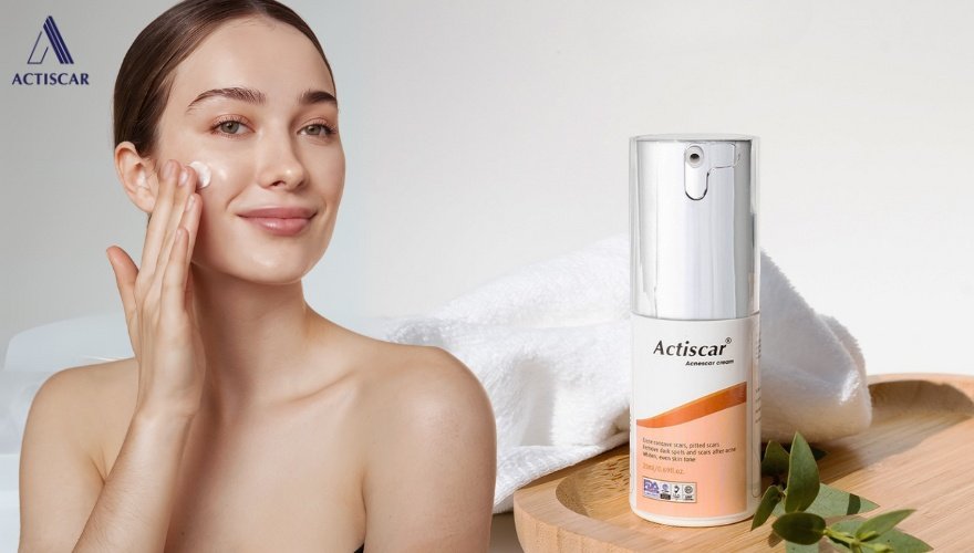 Kem mờ sẹo, sự kết hợp hoàn hảo với Serum sẹo lõm